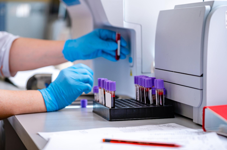 High-quality laboratory microscope used for blood cell analysis at Emage Path Lab